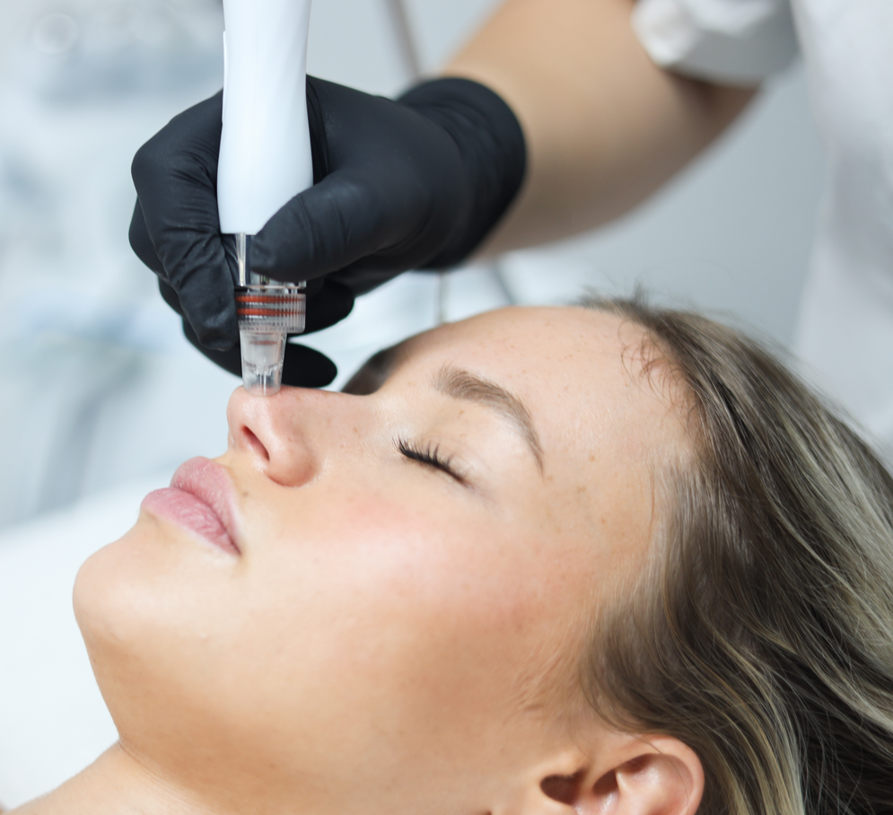 Schoonheidsspecialiste in Gorinchem die microneedling, dieptereiniging uitvoert medik8